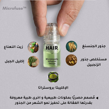 Microfuse | علاج طبي متطور لتساقط الشعر و اعادة النمو