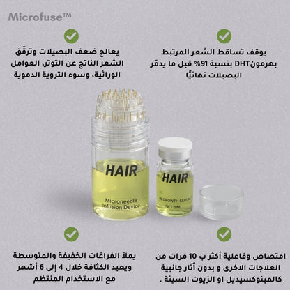 Microfuse | علاج طبي متطور لتساقط الشعر و اعادة النمو