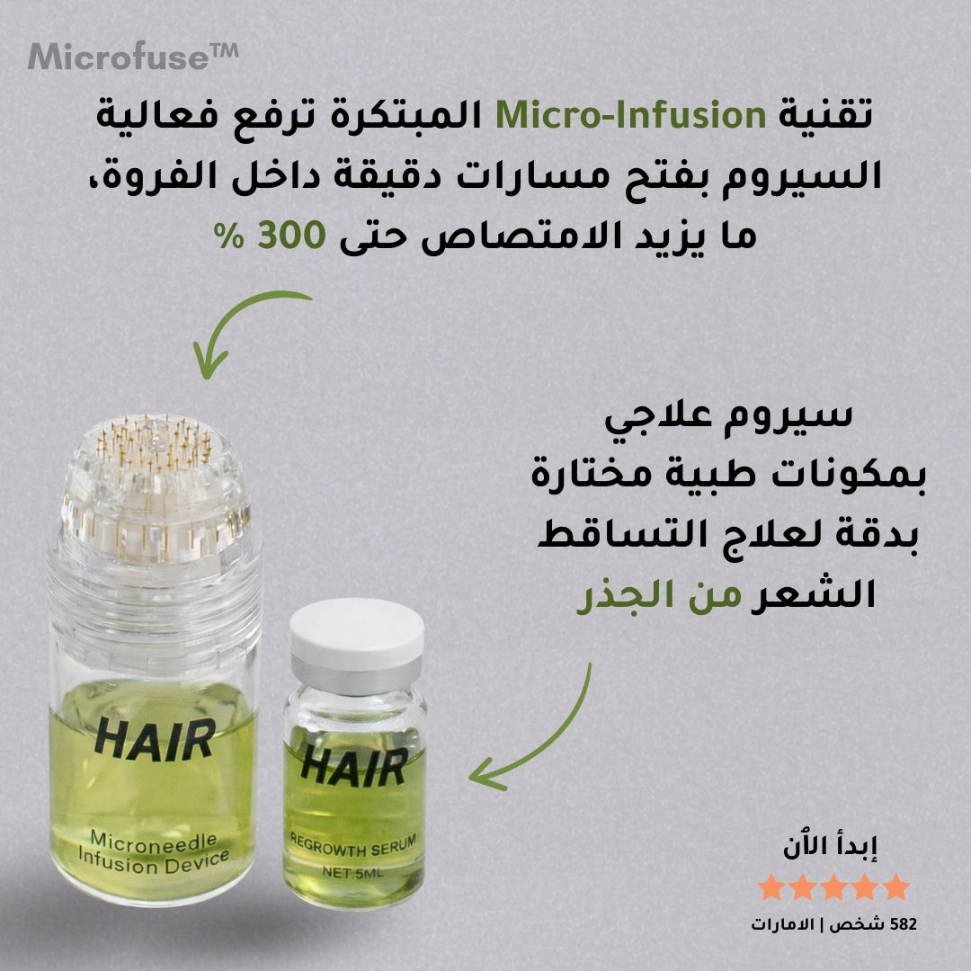 Microfuse | علاج طبي متطور لتساقط الشعر و اعادة النمو