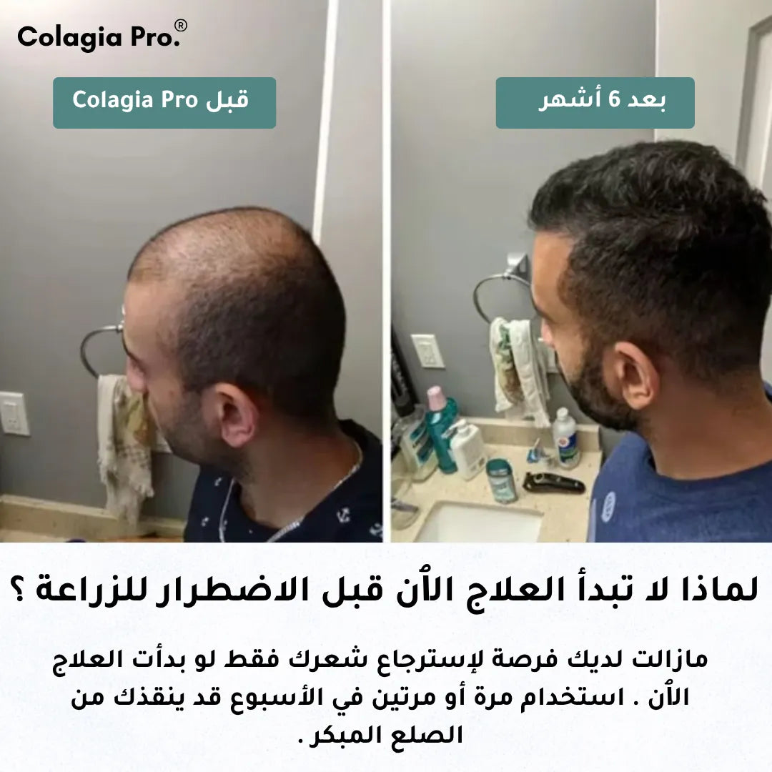 Colagia Pro® | علاج  طبي متطور لتساقط الشعر و استعادة النمو