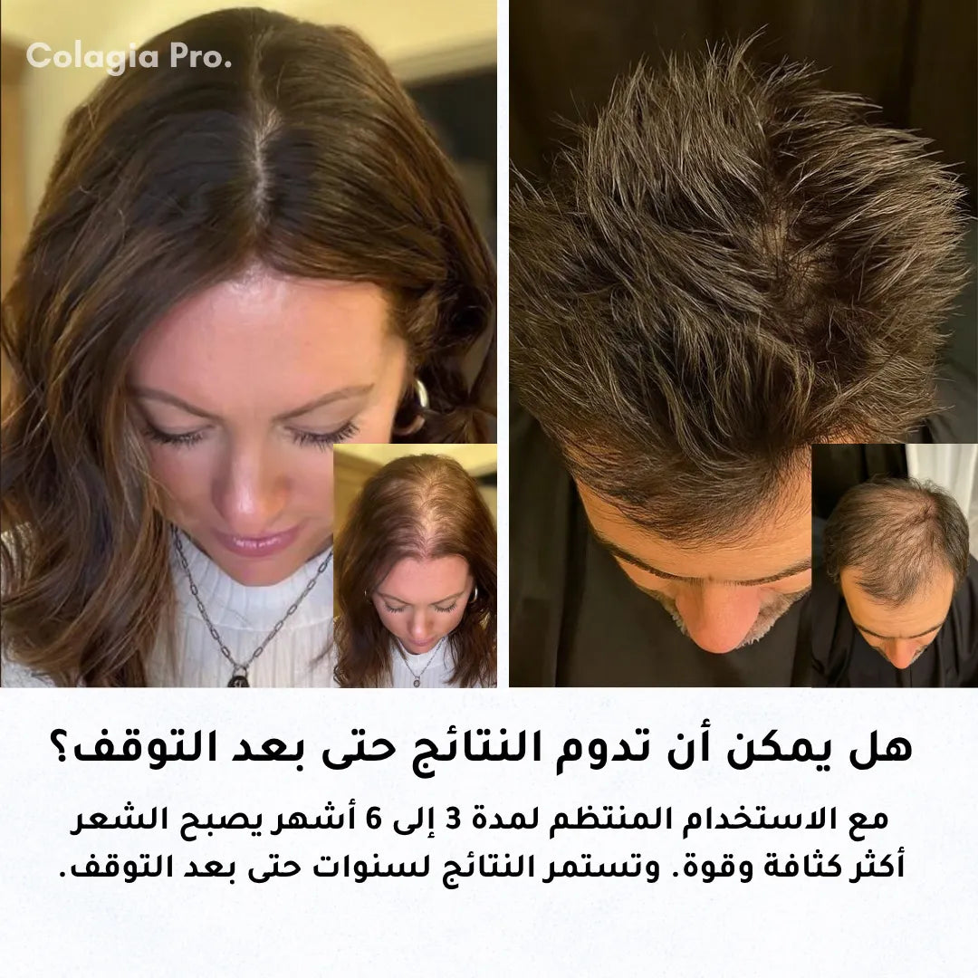 Colagia Pro® | علاج  طبي متطور لتساقط الشعر و استعادة النمو